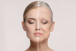 Understanding Why Facial Changes Occur Over the Years: A New Look at Facial Aging