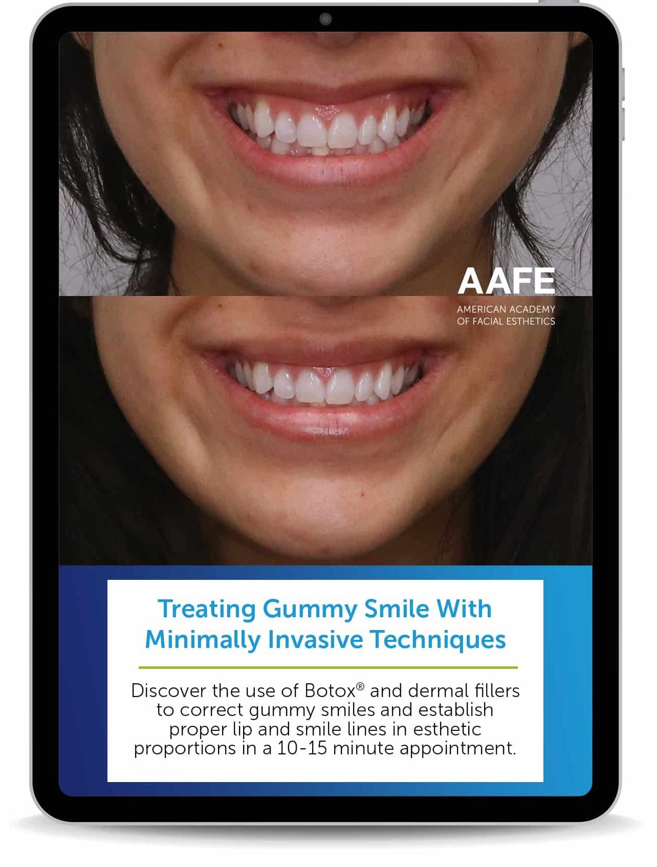 Gummysmile Intablet E1747253395681