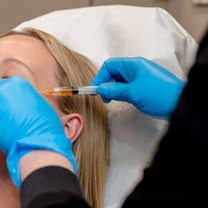 A women getting PRP on her face