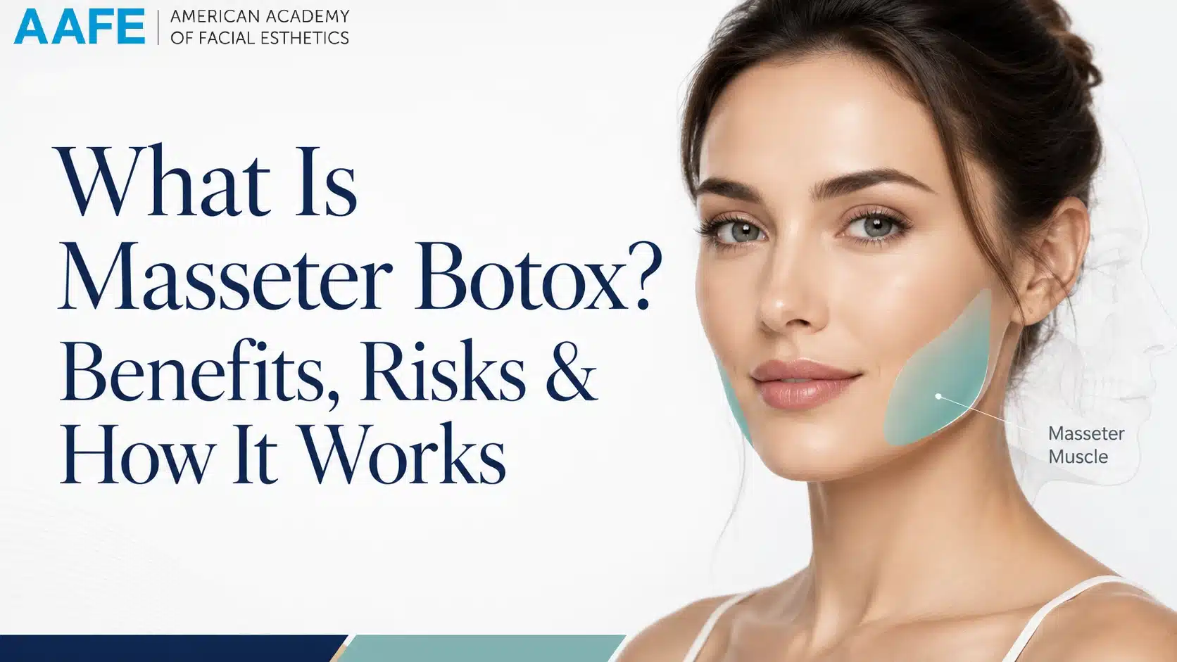 What is masseter botox cover