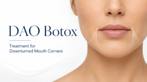 DAO Botox: How It Helps Downturned Mouth Corners