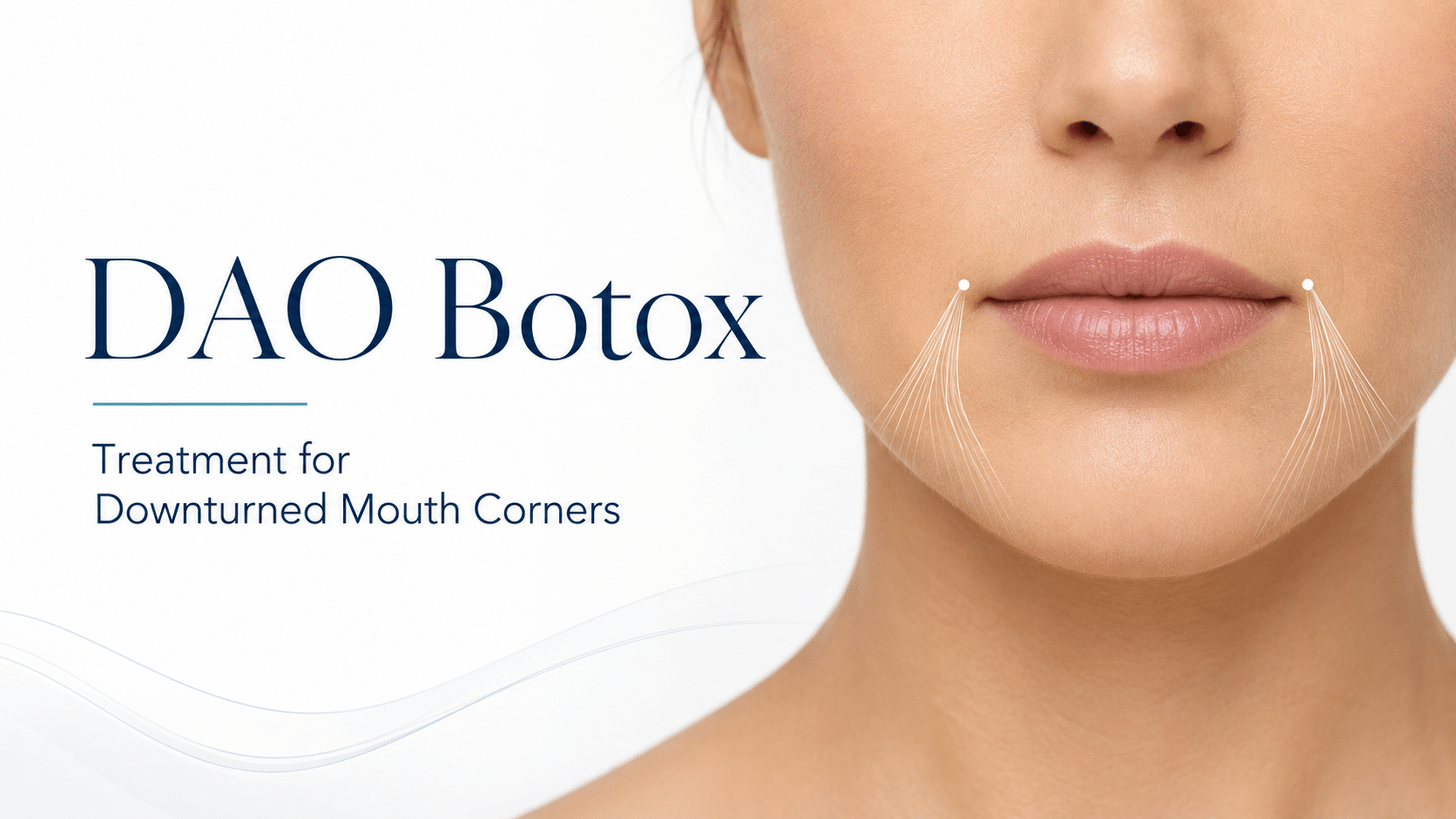 Dao Botox Featured Image Showing Treatment Area For Downturned Mouth Corners And Lower-Face Muscle Pull Near The Depressor Anguli Oris