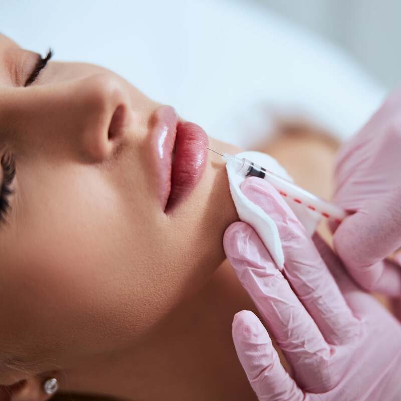 Lady Laying With Her Eyes Closed During Lip Filler Injection
